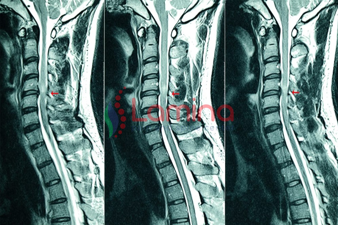 Saraf Leher Kejepit: Ciri dan Bahayanya