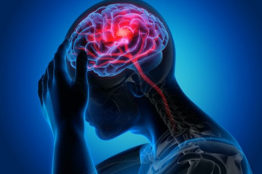 Hubungan Antara Stroke Dengan Demensia