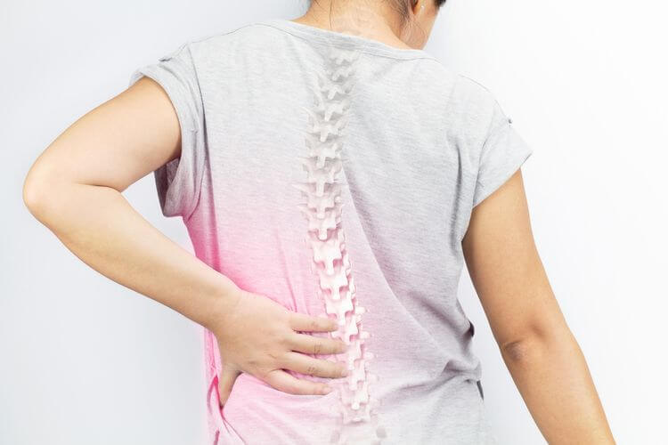 Spondilitis Tuberkulosis: Penyebab, Gejala dan Penanganannya